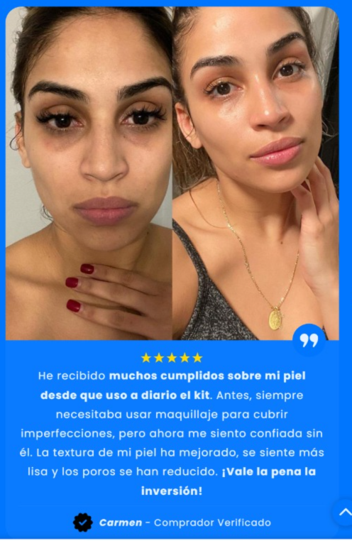 Contorno de ojos, foto 3